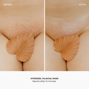 Masque vajacial hydrogel Bushbalm (Triangle)