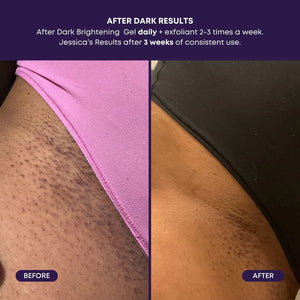 Bushbalm After Dark Brightening Gel (50 ml)