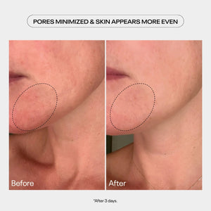 TUEL AHA Moment Double Action Resurfacing Serum (2 oz)