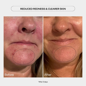 TUEL AHA Moment Double Action Resurfacing Serum (2 oz)