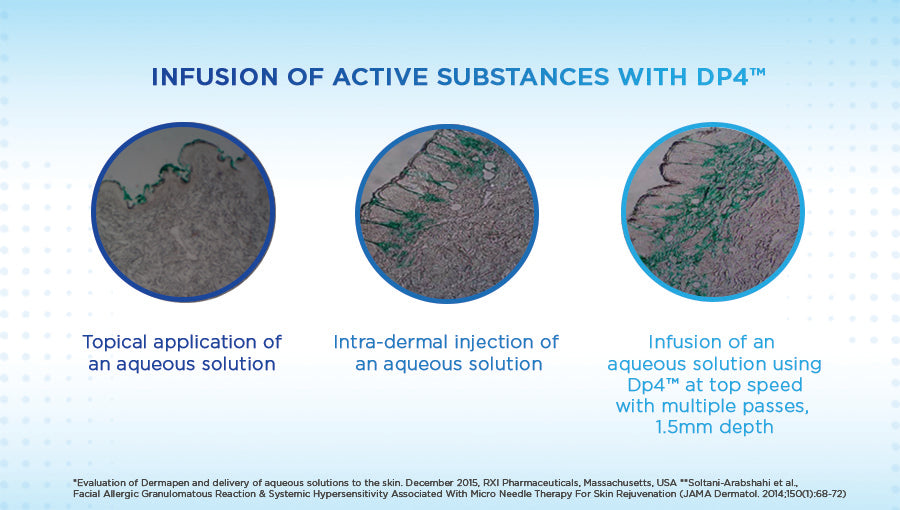 Clarion DP4 Microneedling Device