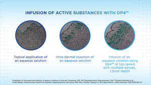 Clarion DP4 Microneedling Device