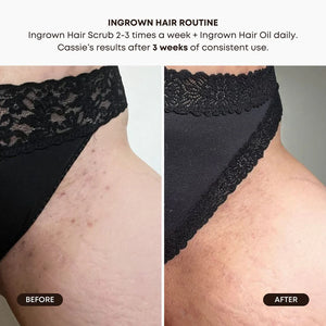 Bushbalm Watermelon Sugar Ingrown Hair Oil (30 ml)