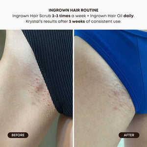 Bushbalm Watermelon Sugar Ingrown Hair Oil (30 ml)