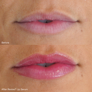 Revive7 Lip Serum 5 ml (Lip Shine - Clear)