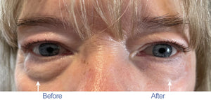 RWND25 Instant Wrinkle Reducer (0.5 oz)