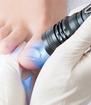 Onylux LED Blue Light Set