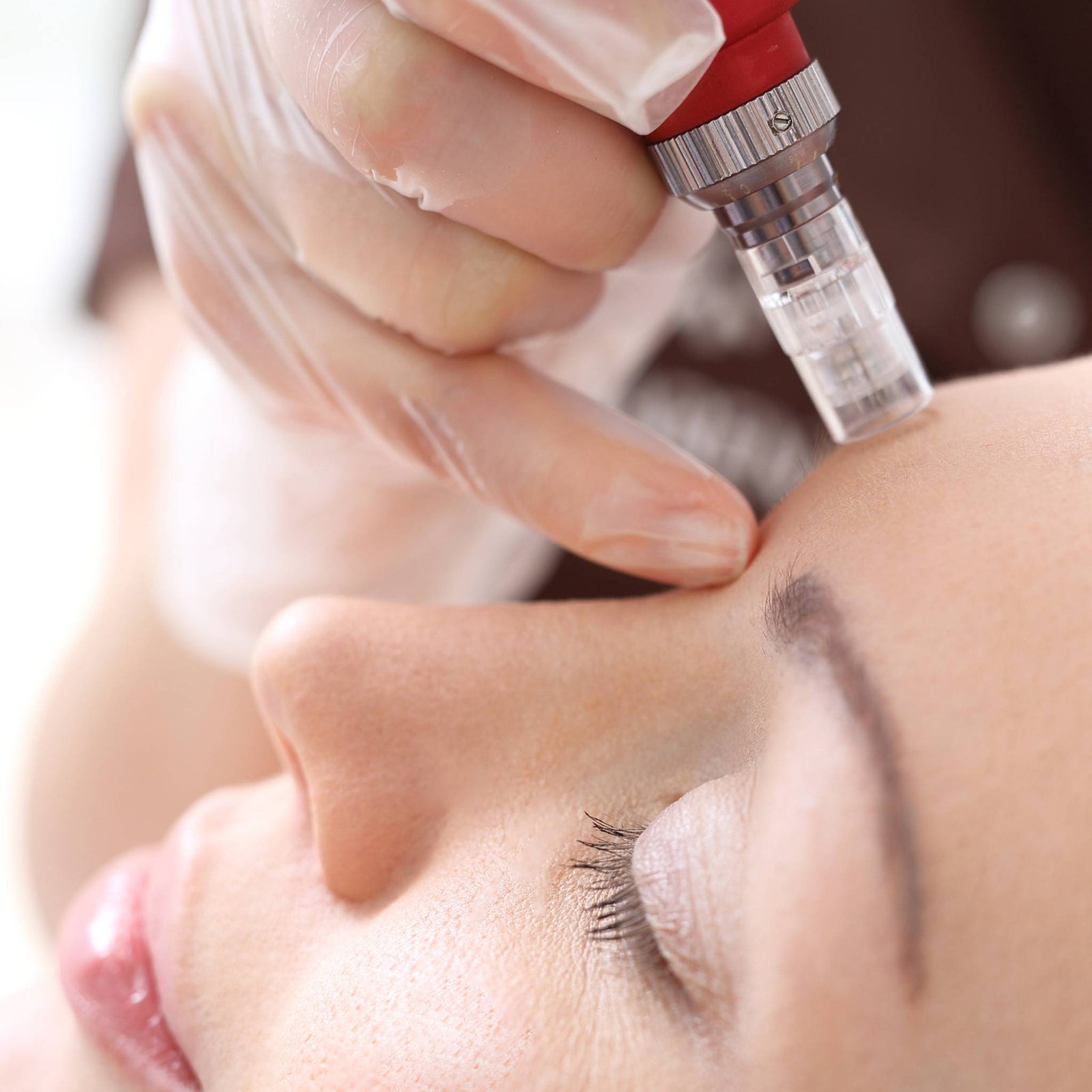 The Esthetic Institute - Dermal Needling Class Wish List