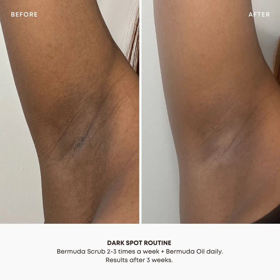 Bushbalm Bermuda Dark Spot Oil (30 ml)