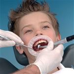 Beyond Optragate Small Refills