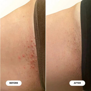 Bushbalm Vanilla Coconut Ingrown Hair Oil (30 ml)