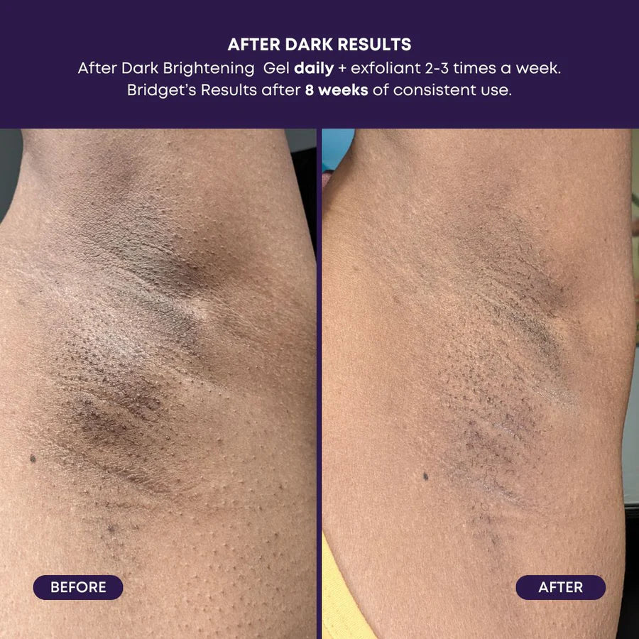 Bushbalm After Dark Brightening Gel (50 ml)