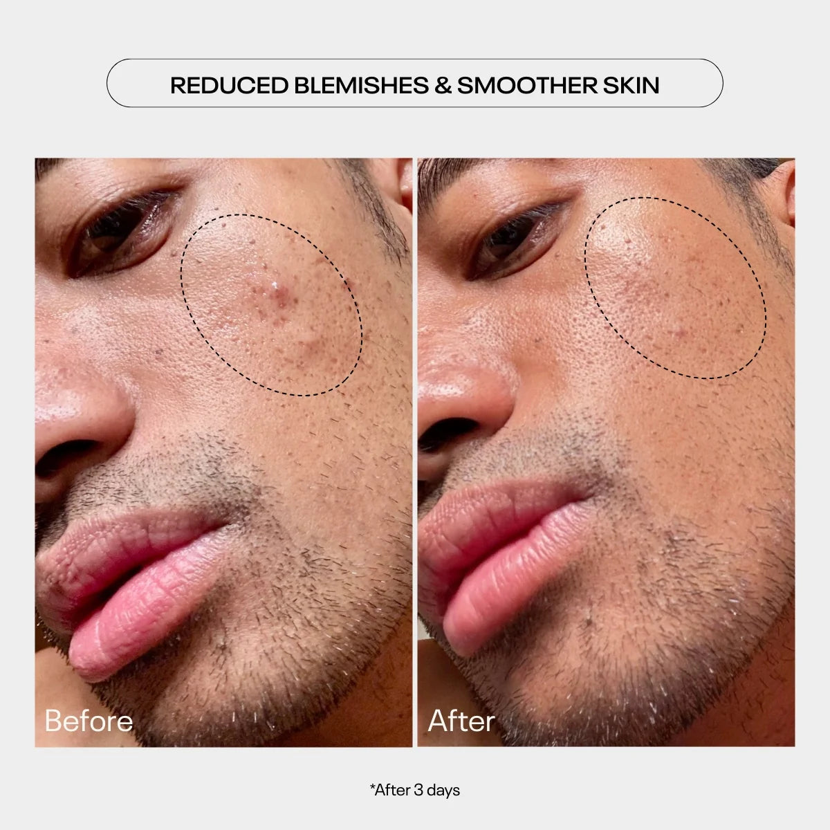 TUEL AHA Moment Double Action Resurfacing Serum (2 oz)