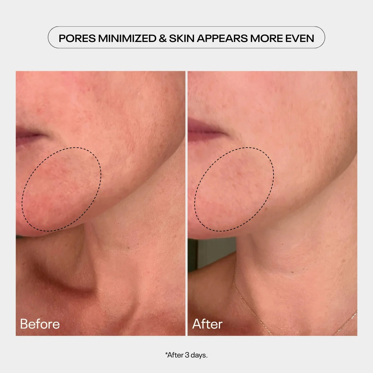 TUEL AHA Moment Double Action Resurfacing Serum (2 oz)