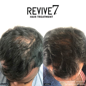 Revive7 Revitalizing Hair Treatment