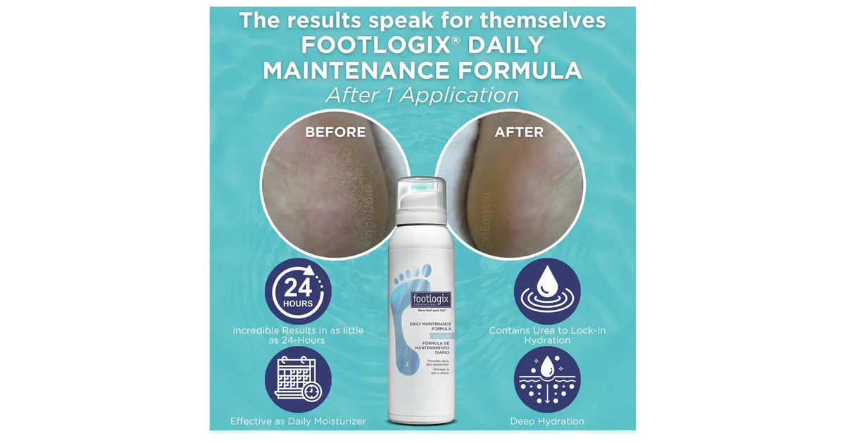 Footlogix Day &amp; Night Combo Kit