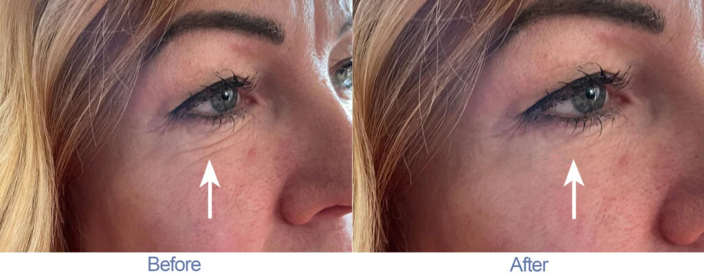 RWND25 Instant Wrinkle Reducer (0.5 oz)