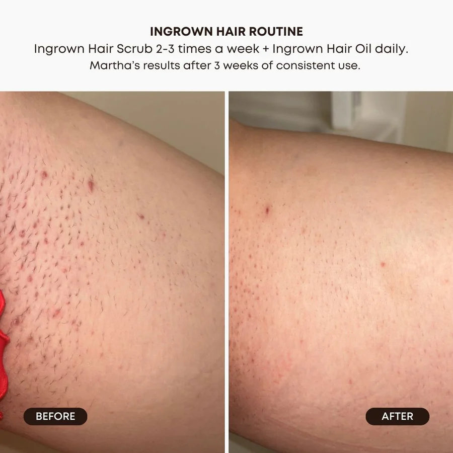 Bushbalm Watermelon Sugar Exfoliating Scrub (8 oz)