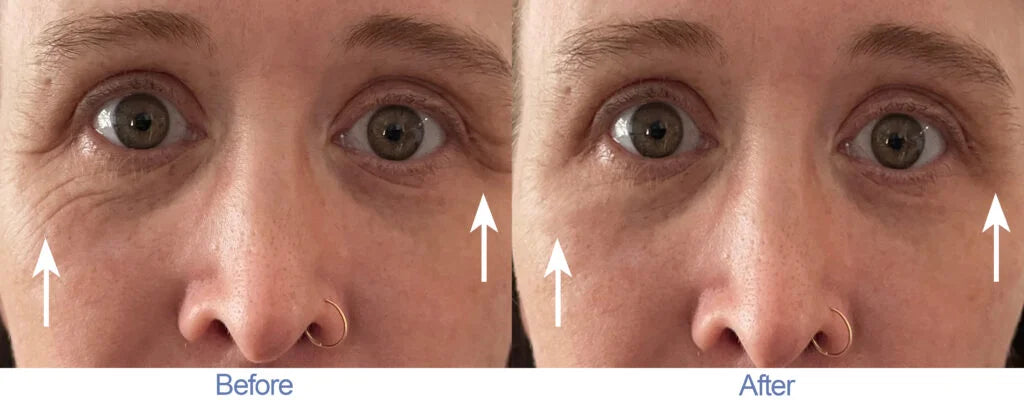 RWND25 Instant Wrinkle Reducer (0.5 oz)