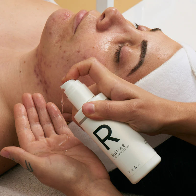TUEL Rehab Acne Healing Serum PRO (4 oz)